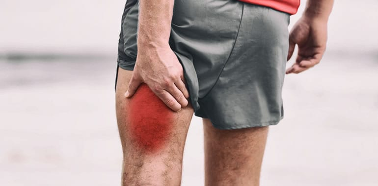 Why a Herniated Disc Can Cause Radiating Leg Pain