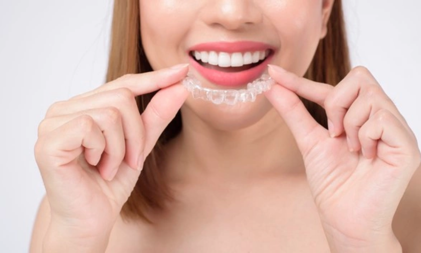 Tips for Keeping Your Invisalign Aligners Clean