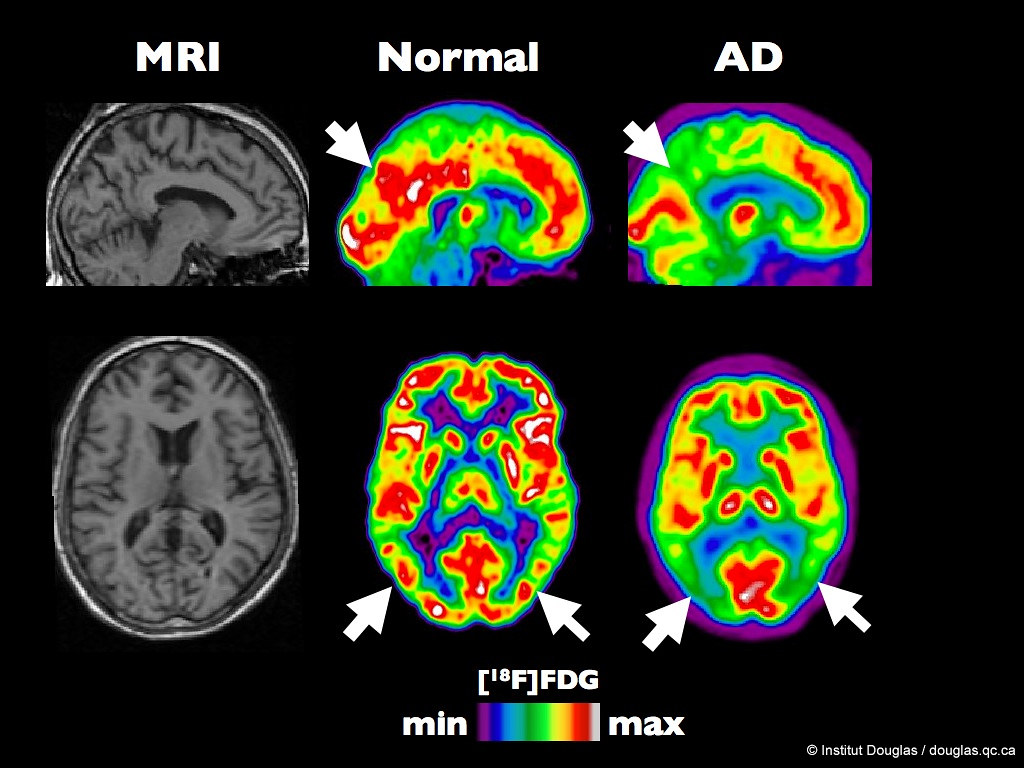Understanding the Differences Between MRI and CT Imaging Techniques