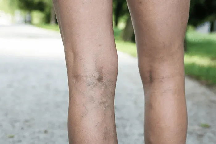 Comprehensive Services Available at a Modern Vein Clinic