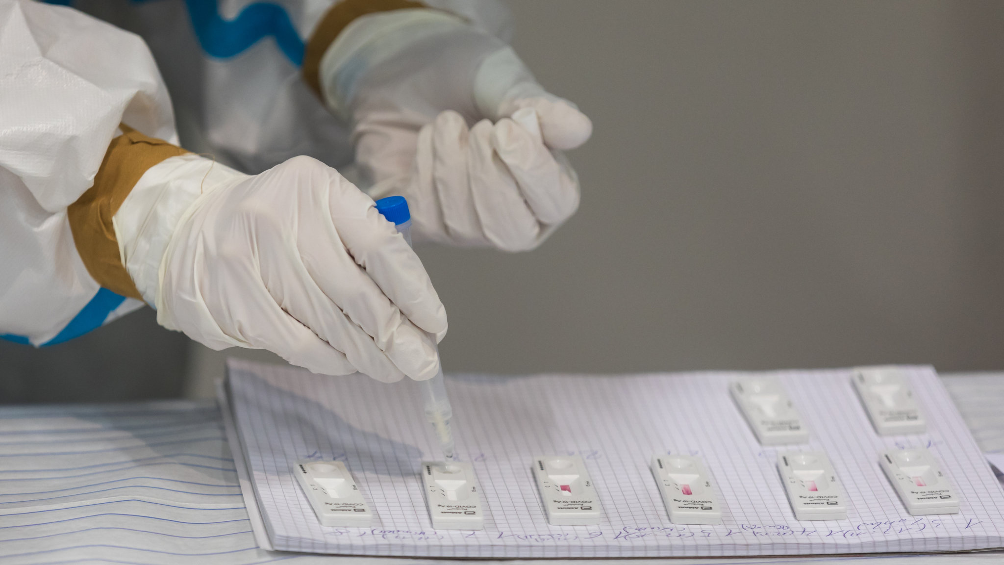How To Prepare for Your COVID Testing Appointment