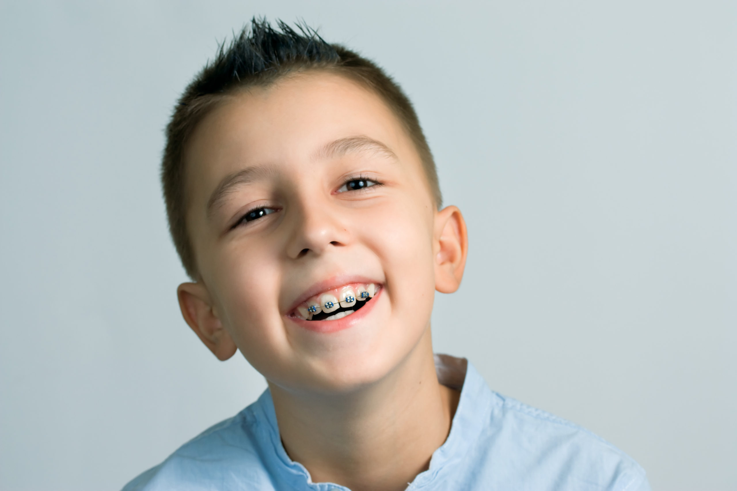 The Long-Term Benefits of Investing in Braces for Your Child