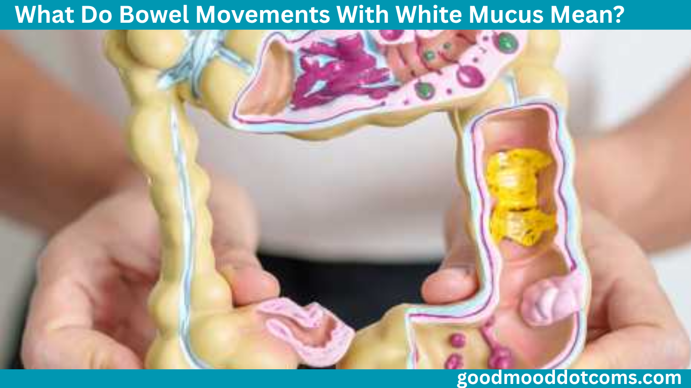 What Do Bowel Movements With White Mucus Mean